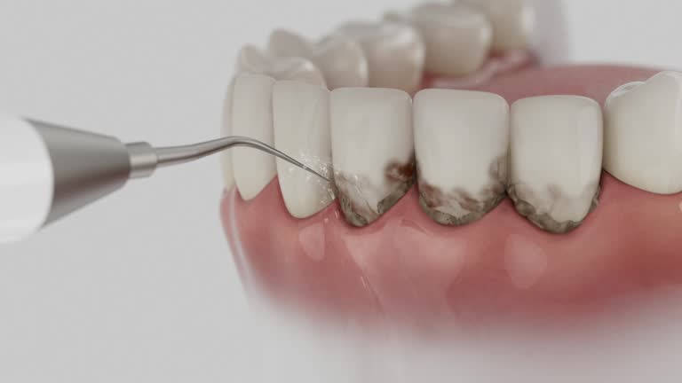 Trusted Teeth Cleaning And Checkup service in Richmond, VA - Dentist Open Now